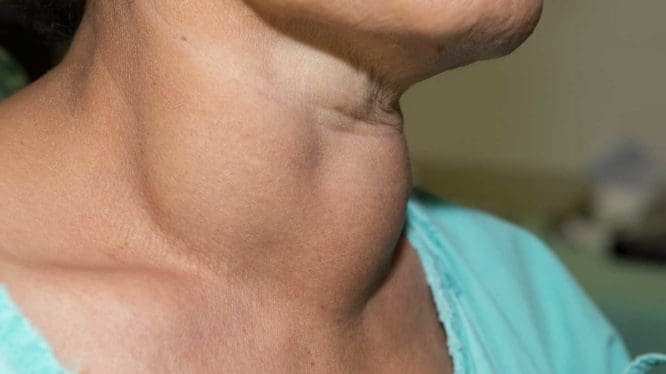thyroid clinic in ulwe sector 21
